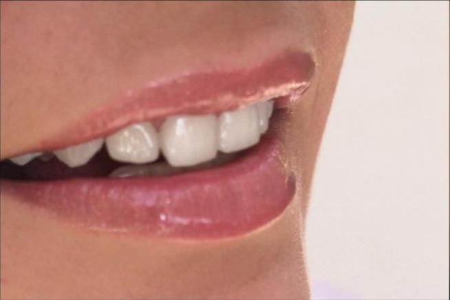 Coroa de Porcelana