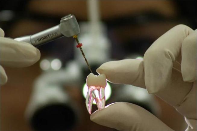Endodontia — Tratamento de Canal
